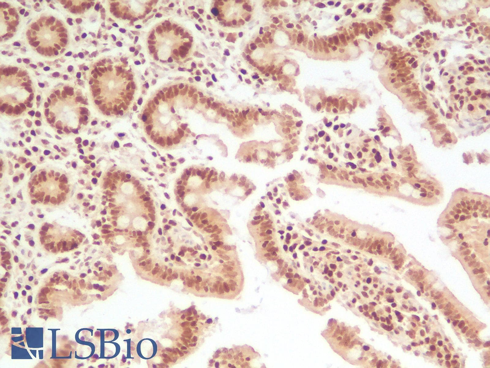 PathPlus™ TFE3 Antibody (Concentrated)