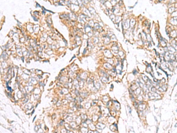 GPC2 / Glypican 2 Antibody