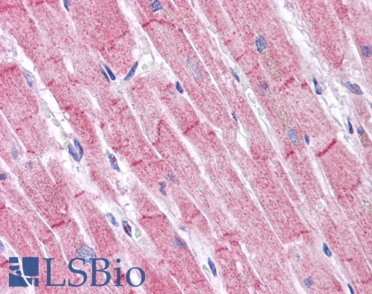 IHC-plus™ RHBDD3 Antibody