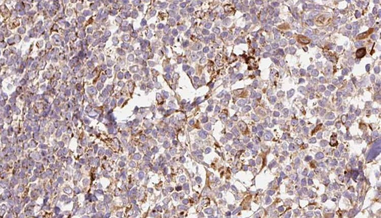 Polyclonal Rabbit anti-Human MMP13 Antibody (IHC, IF, WB)