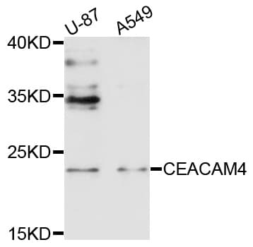 Polyclonal Rabbit anti-Human CEACAM4 Antibody (WB)