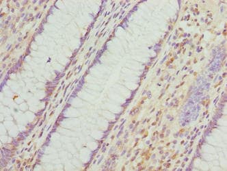 VWA9 / C15orf44 Antibody