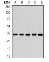 Polyclonal Rabbit anti-Human PSMD7 / MOV34 Antibody (IHC, IF, WB)