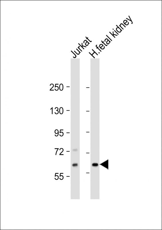 EPHX2 / Epoxide Hydrolase 2 Antibody (N-Terminus)