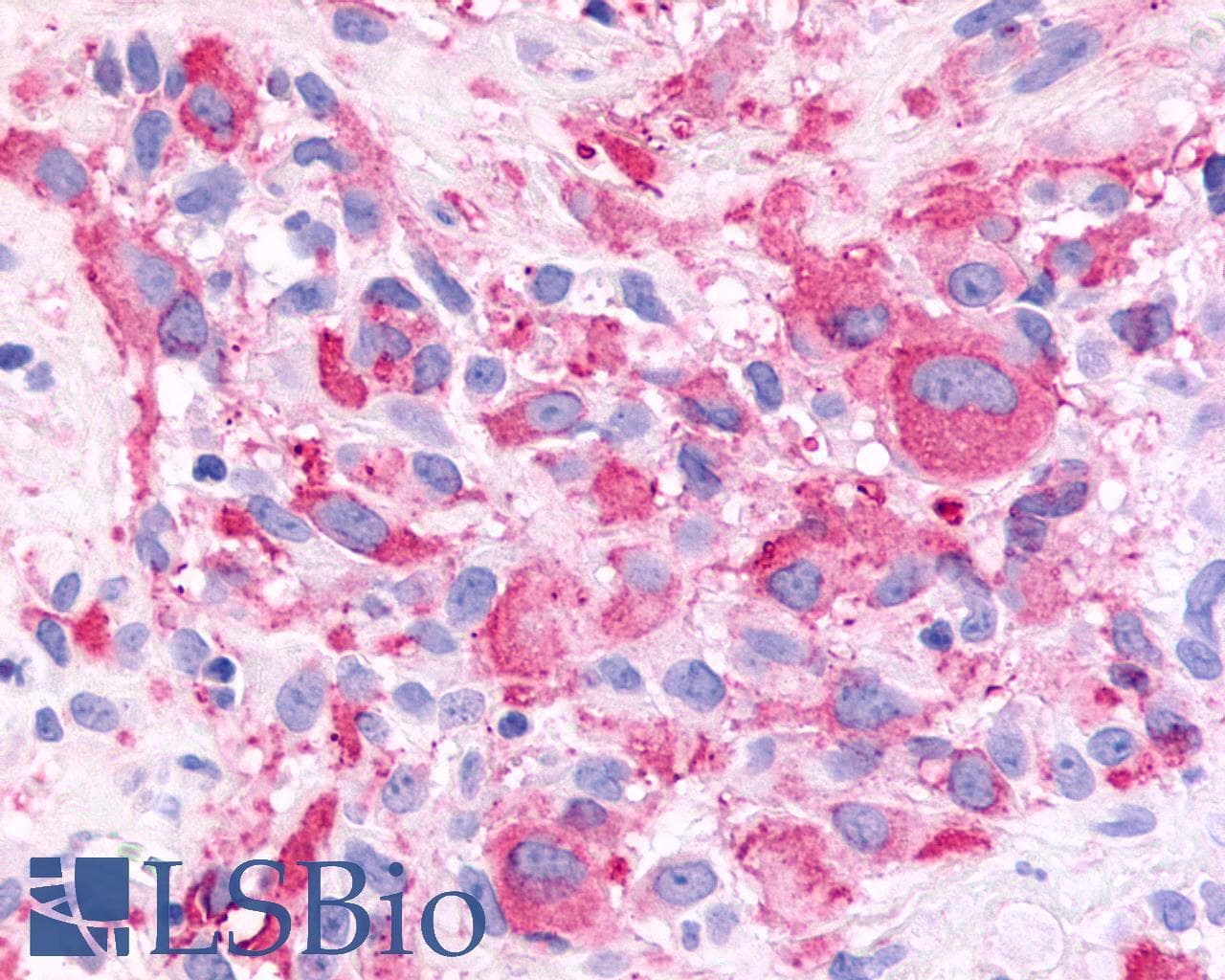 IHC-plus™ FZD2 / Frizzled 2 Antibody (Extracellular Domain)