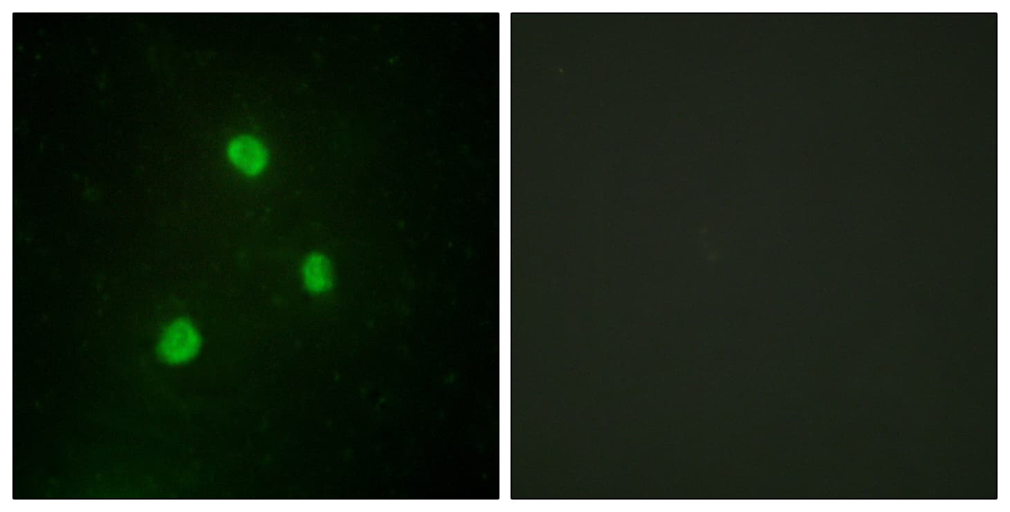 TBX1 Antibody (aa311-360)