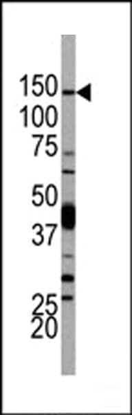 PIK3CD / PI3K Delta Antibody (aa85-114)