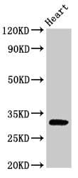 IHC-plus™ PPP1R3B Antibody
