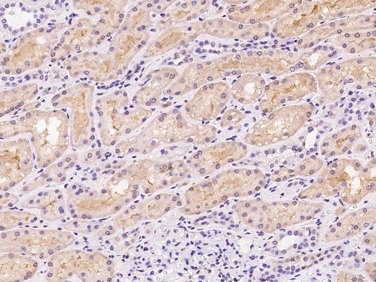 HPD Antibody