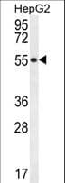 UXS1 Antibody (aa337-366)