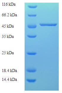 Human CAPZA2 / CAPZ Alpha 2 Protein (Recombinant His-SUMO)