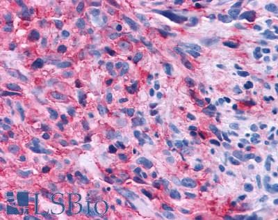 PathPlus™ GPR108 Antibody (Cytoplasmic Domain)