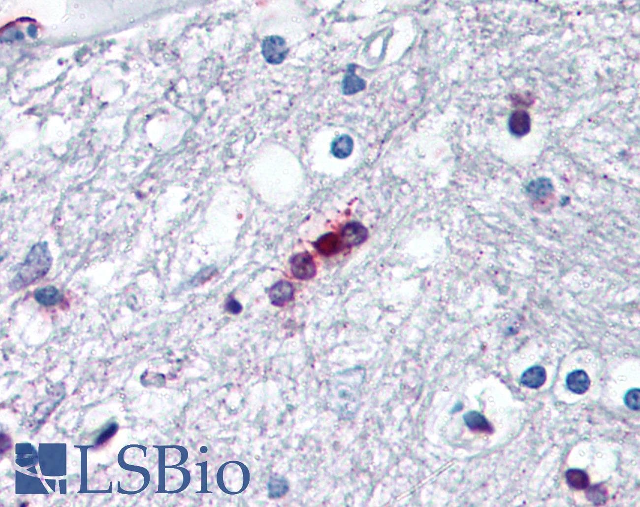 IHC-plus™ MBP / Myelin Basic Protein Antibody (aa130-136)