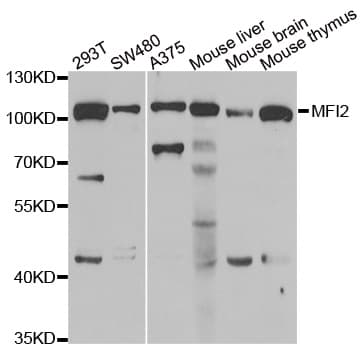 Polyclonal Rabbit anti-Human MFI2 / p97 Antibody (IHC, WB)