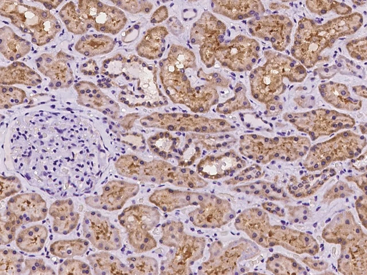 SLC2A7 / GLUT7 Antibody