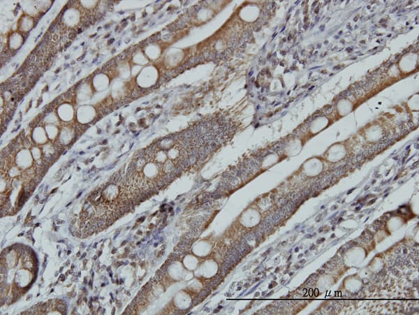 MRRF Antibody (clone 1D3)