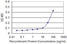 IHC-plus™ NFAT4 / NFATC3 Antibody (clone 3A12)