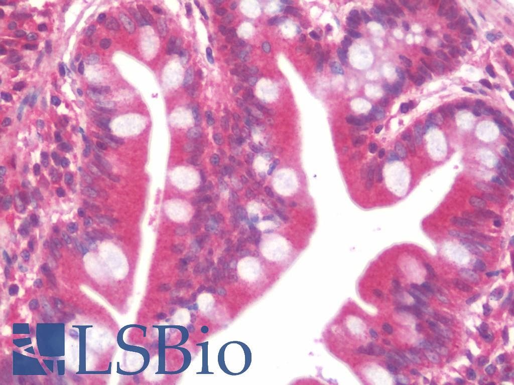 IHC-plus™ CALCR / Calcitonin Receptor Antibody (clone 2F7)