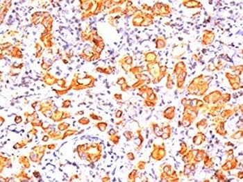 EMA / MUC1 Antibody (clone GP1.4, Ready-to-Use)