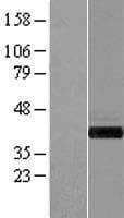 GIPC1 / GIPC Protein (Over-Expression Lysate Myc-DDK (Flag))