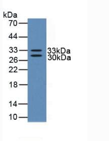 Human NGF Protein (Recombinant His, N-Terminal)