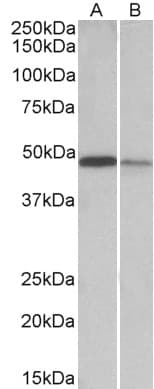 IHC-plus™ Polyclonal Goat anti-Human TXNDC5 / ERP46 Antibody (aa281-295, IHC, WB)