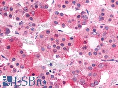 IHC-plus™ Polyclonal Rabbit anti-Human GHRHR Antibody (C-Terminus, IHC)