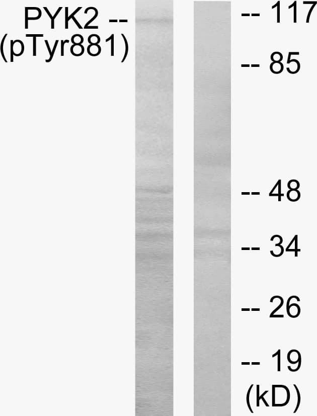 PTK2B / PYK2 Antibody (phospho-Tyr881)