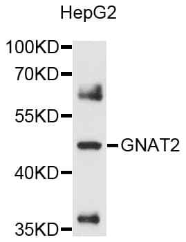Polyclonal Rabbit anti-Human GNAT2 Antibody (WB)