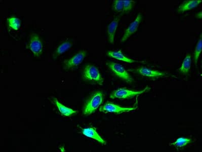 PLP1 / Myelin PLP Antibody (aa143-197)