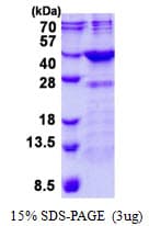 Human FN3K / Fructosamine-3-Kinase Protein (Recombinant His)