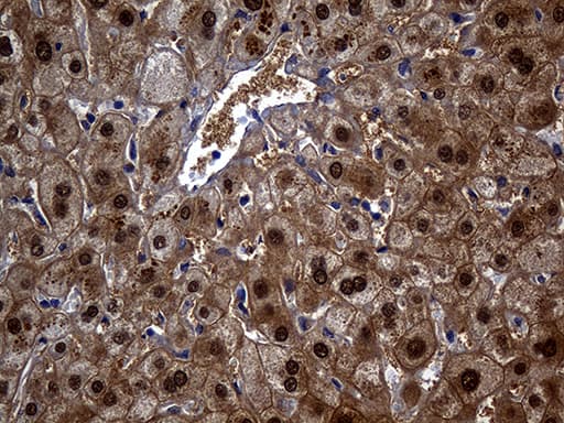 ASL / Argininosuccinate Lyase Antibody (clone OTI9G2, Carrier-free)