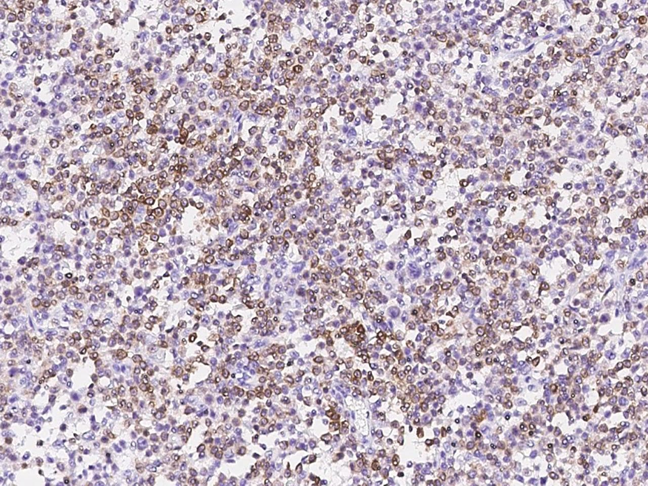 Monoclonal Mouse anti-Human BCL2 / Bcl-2 Antibody (clone 17, Preservative Free, IHC, WB)