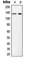 Polyclonal Rabbit anti-Human MN1 Antibody (Internal, WB)