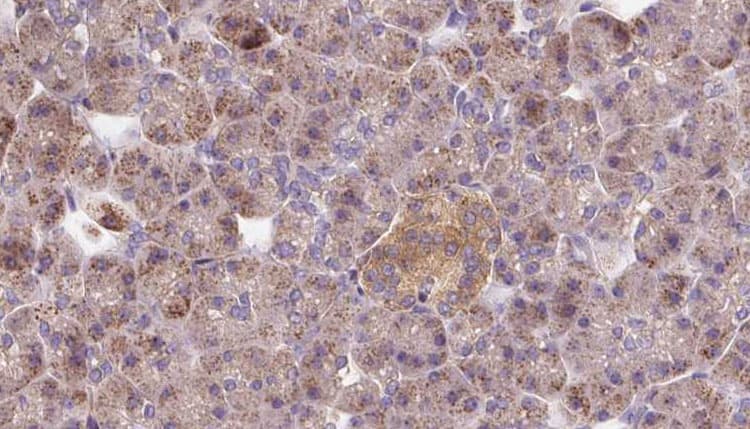 Polyclonal Rabbit anti-Human OPHN1 Antibody (IHC, IF, WB)