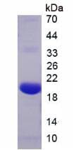 Rat RLN1 / Relaxin Protein (Recombinant His, N-Terminal)