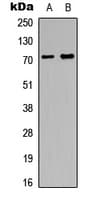 MAP3K1 / MEKK1 Antibody (N-Terminus)
