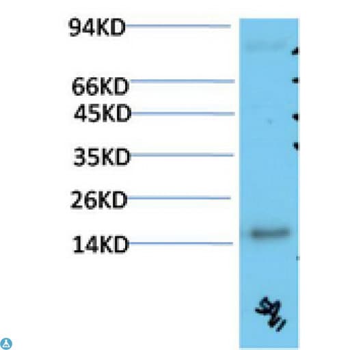 TTR / Transthyretin Antibody