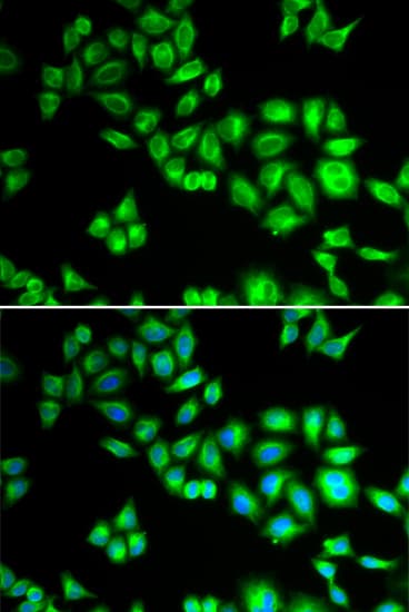 Polyclonal Rabbit anti-Human CUL1 / Cullin 1 Antibody (IHC, IF, WB)
