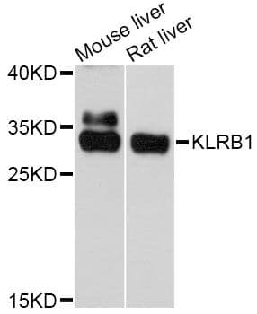 KLRB1 / CD161 Antibody