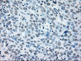 IRF3 Antibody (clone OTI5D2)