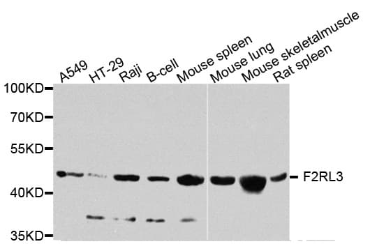 F2RL3 / PAR4 Antibody