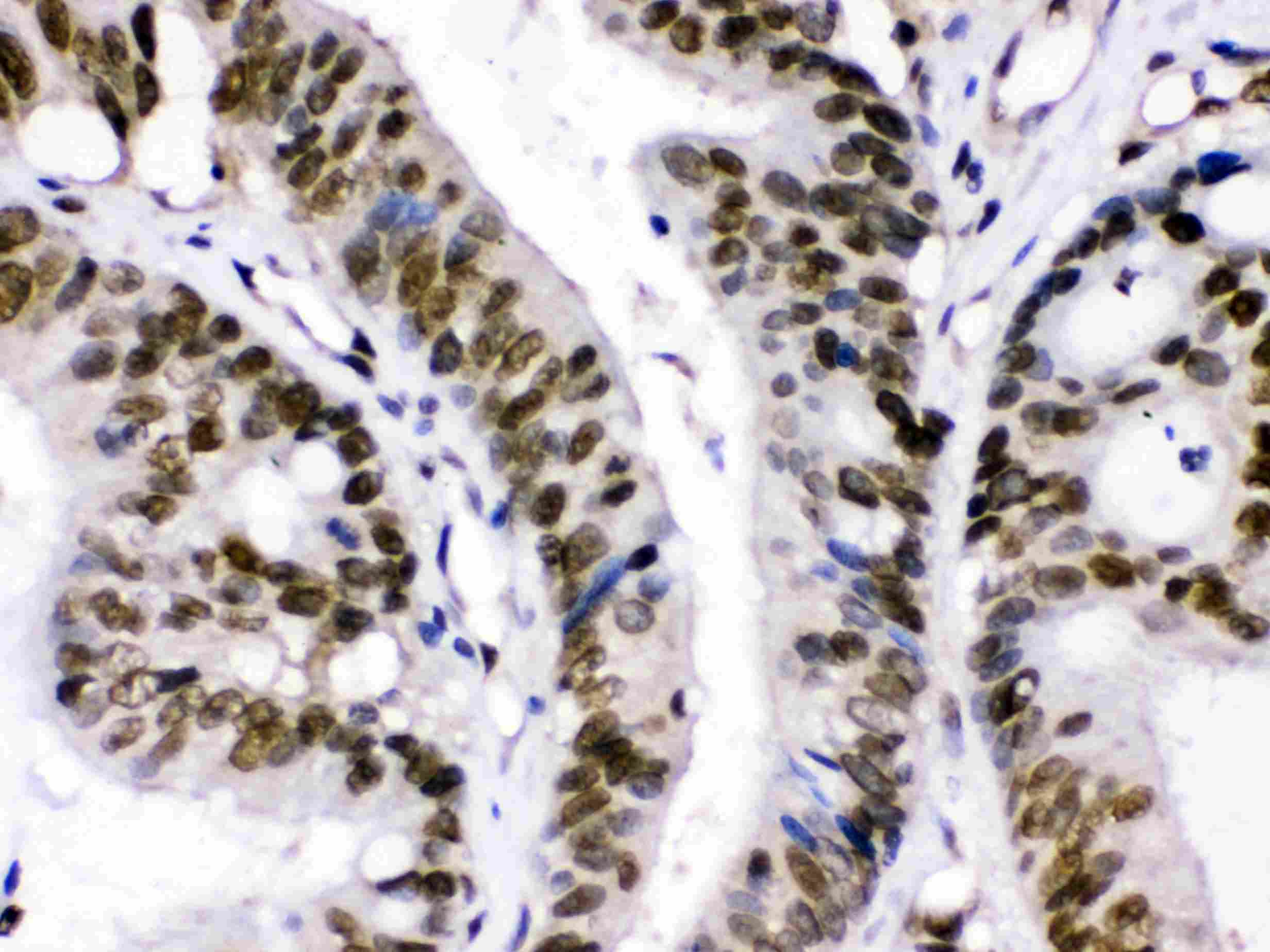 XPO1 / CRM1 Antibody