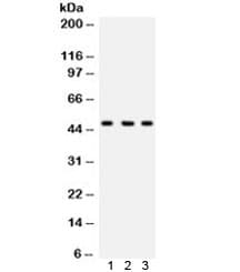 CTBP2 Antibody