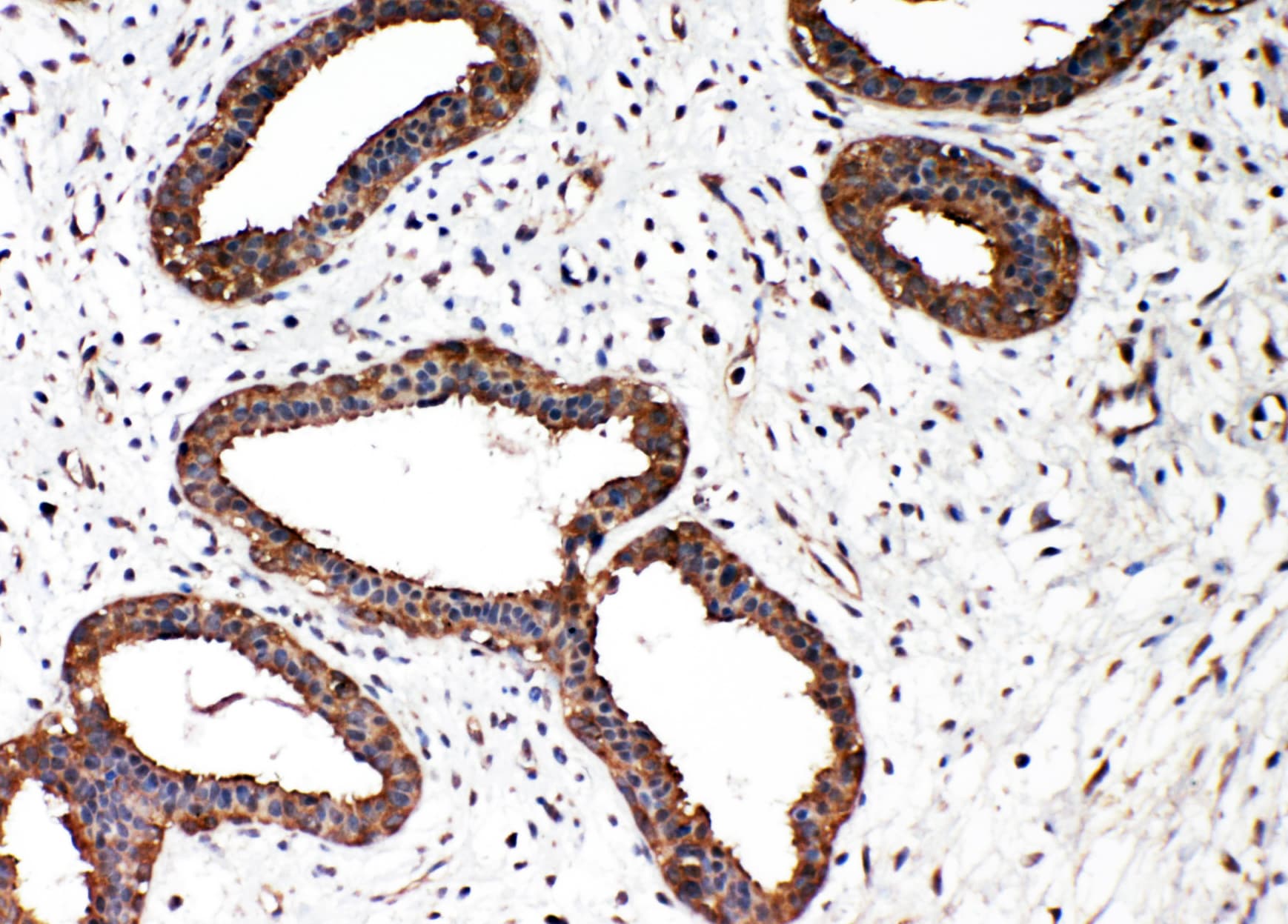 SMAD2 Antibody (aa94-112)