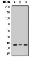 Polyclonal Rabbit anti-Human TAS2R14 / TRB1 Antibody (Internal, IF, WB)