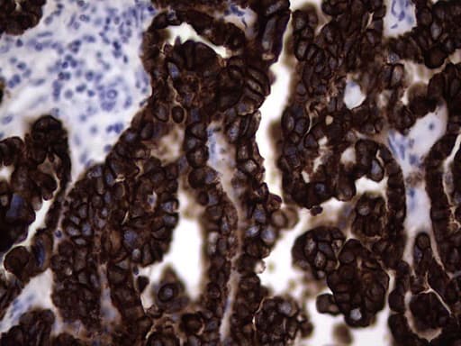 Monoclonal Mouse anti-Human KRT19 / CK19 / Cytokeratin 19 Antibody (clone OTI9A9, aa240-390, IHC)