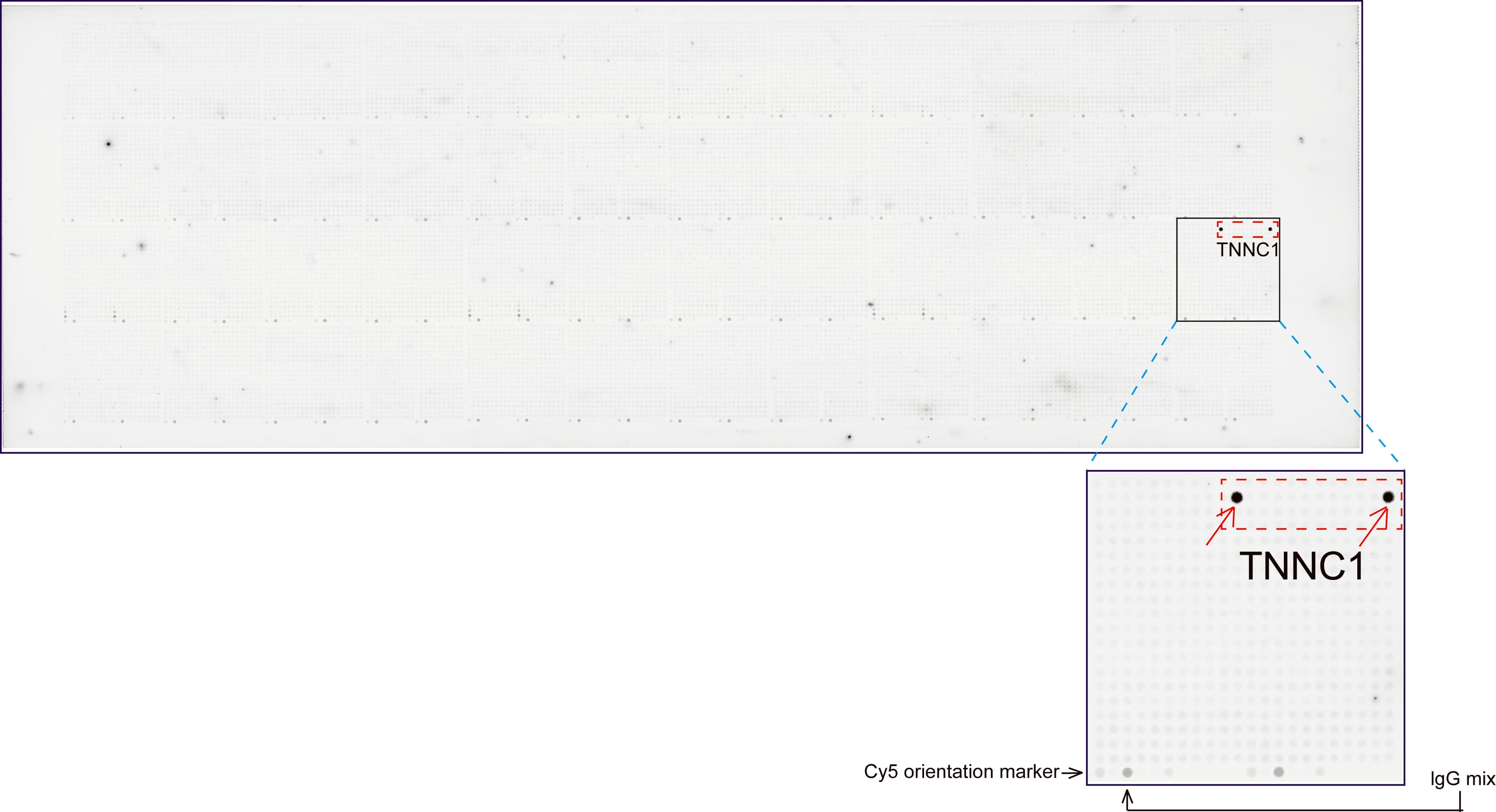 TNNC1 / Cardiac Troponin C Antibody (clone UMAB204)