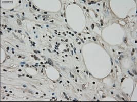 Monoclonal Mouse anti-Human BUB1B / BubR1 Antibody (clone OTI15E11, IHC, IF, WB)