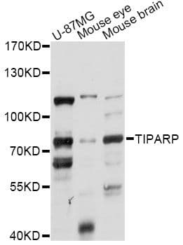PARP7 / TIPARP Antibody